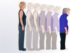 osteoporosi.jpg